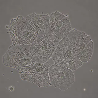 Microscope source showing epithelial cells
